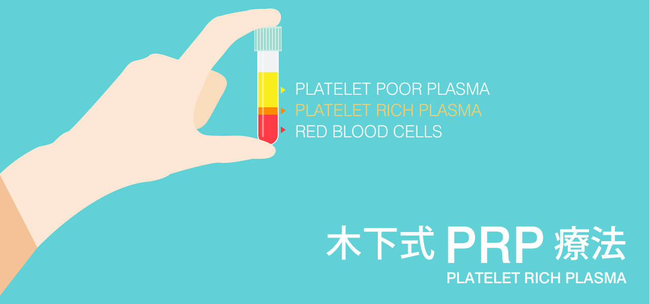 PRP療法